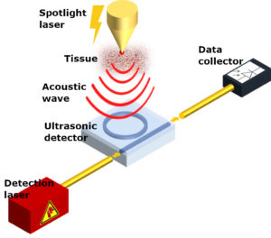 Simplified schematic of a photoacoustic diagnostic tool. Schematic of a photoacoustic diagnostic tool used in Project REAP. The tool will feature tunable lasers from LioniX.